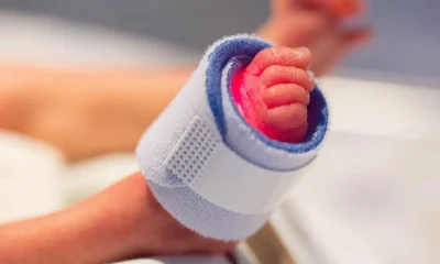 HMPV virus in India 8 month old baby tests positive in Bengaluru hospital amid surge in cases in China Tamil News