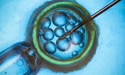 3-parent IVF Technique