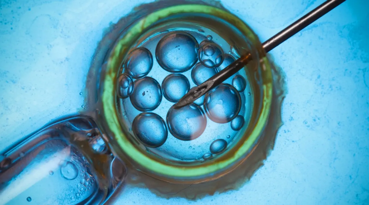 3-parent IVF Technique