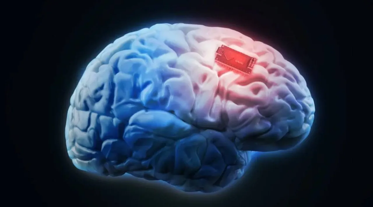 brain implant